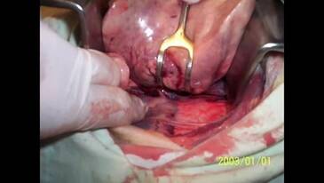 Carcinoma de celulas escamosas en pulmon de un canino