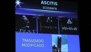 Enfermedad mitral crónica. Complicaciones. diagnóstico terapéutica (parte II)