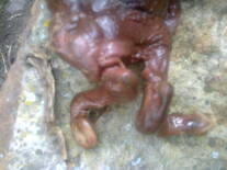 Aborto