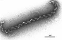 Leptospira spp