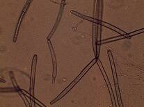 Corynespora sp.