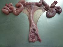 Reconocimiento del cervix