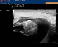 Seguimiento y Diagnóstico por Ultrasonografía en Bovinos y Equinos (Dx de preñez en una vaca).