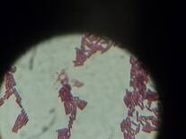 Bacilos gram negativos de Serratia