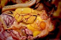 Ovoperitonitis en ponedoras