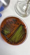 E. coli en agar EMB