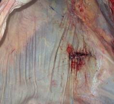 Proceso de cicatrización en peritoneo después de una cesárea 