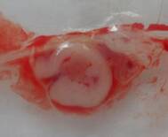 Embrión bovino