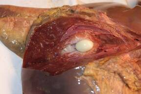 Tumor hepático en bovinos