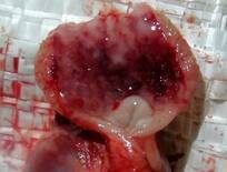 8. Haemorrhages in proventriculus