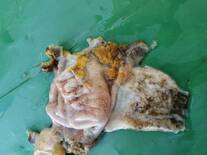 gizzard erosion