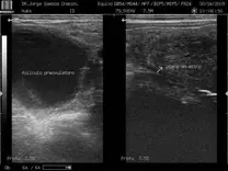 Ecografia en equinos