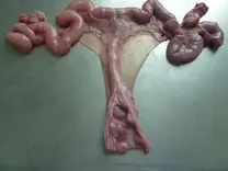 Reconocimiento del cervix
