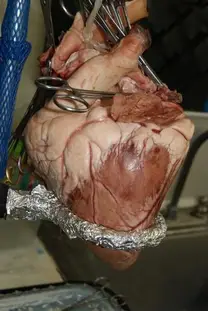 Perfusion de Corazón