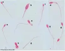 Morfologia espermática del semen