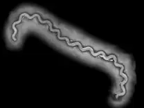 Imagen de Leptospira spp.