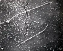 Leptospira spp.