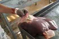 Tumor hepático de un bovino con clenbuterol
